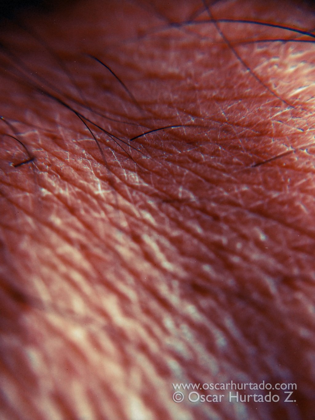 La Peau - Macro color photograph (2014)